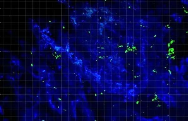 Fluorescence microscopy of tumour tissue. Engineered bacteria appear as discrete green rods distributed through blue-stained tumour stroma, with the acquisition scale grid overlaid.
