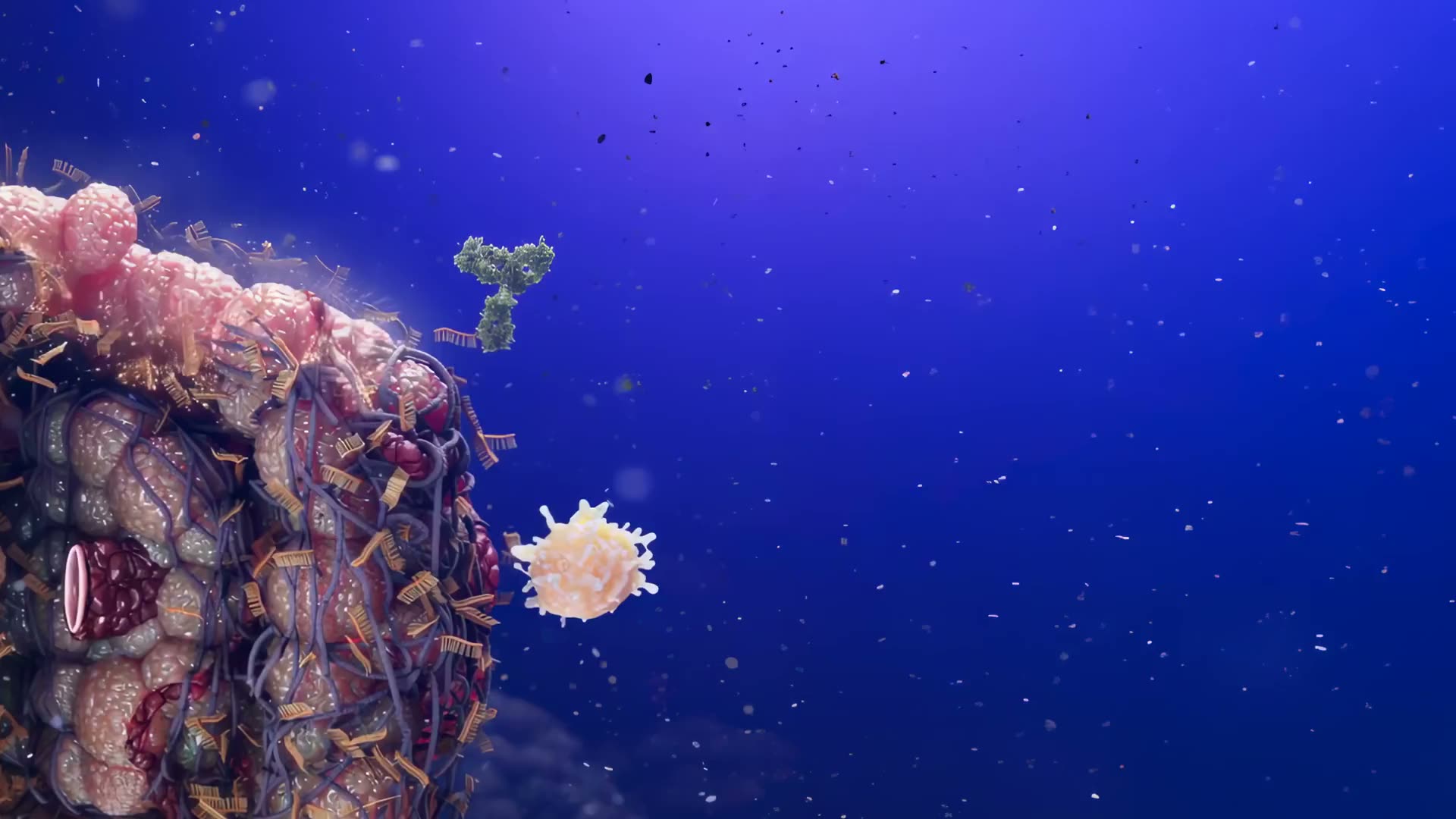 A solid tumour enclosed by a dense fibrotic stroma, with immune cells and antibodies held outside it.